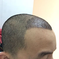 發(fā)際線用戶圖片
