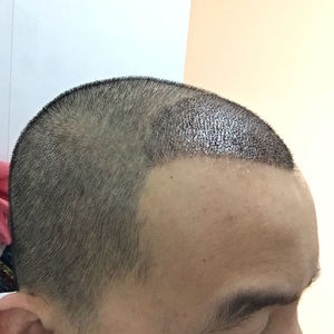 发际线分享社区
