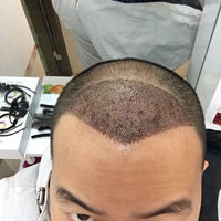 發(fā)際線用戶圖片
