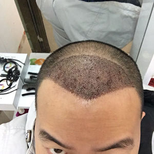 发际线分享社区