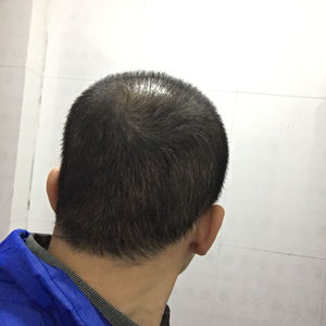 发际线分享社区