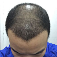 發(fā)際線用戶圖片