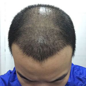 发际线分享社区