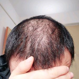发际线分享社区