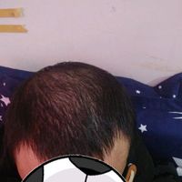 發(fā)際線用戶圖片