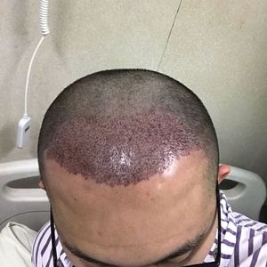 发际线分享社区