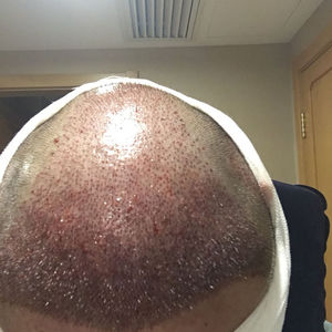 发际线分享社区