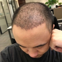 發(fā)際線用戶圖片