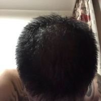 禿頂用戶圖片