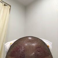 發(fā)際線用戶圖片