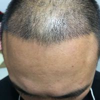 生發(fā)養(yǎng)護用戶圖片