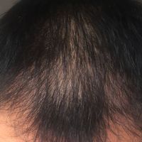 發(fā)際線用戶(hù)圖片