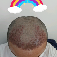發(fā)際線用戶(hù)圖片