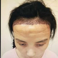 發(fā)際線用戶(hù)圖片