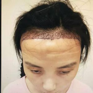 发际线分享社区