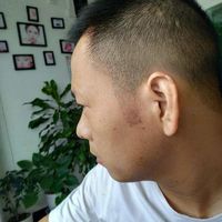 種植鬢角用戶(hù)圖片
