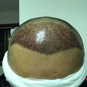发际线分享社区