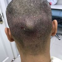 發(fā)際線用戶圖片