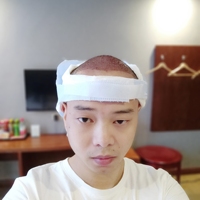 發(fā)際線用戶圖片
