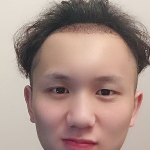 发际线分享社区