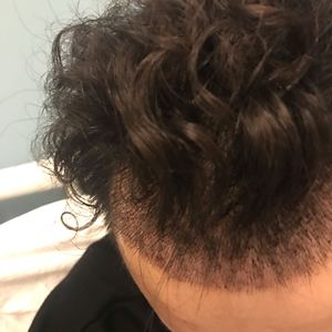 发际线分享社区