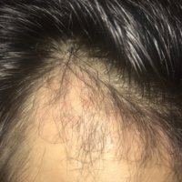 發(fā)際線用戶圖片