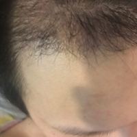 發(fā)際線用戶圖片
