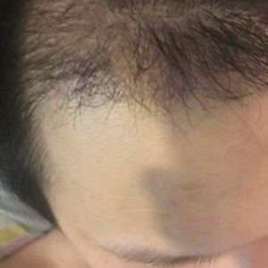 发际线分享社区