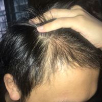 發(fā)際線用戶圖片