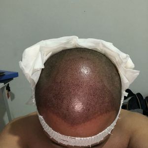 发际线分享社区