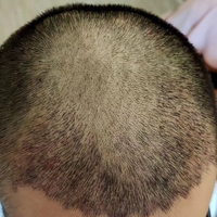 發(fā)際線用戶圖片