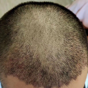 发际线分享社区