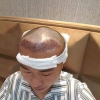 發(fā)際線用戶圖片