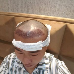 发际线分享社区