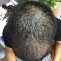 生發(fā)養(yǎng)護(hù)用戶圖片
