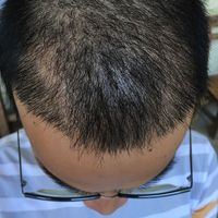 發(fā)際線用戶圖片