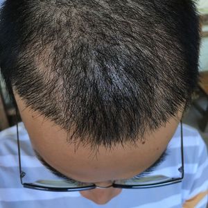 发际线分享社区