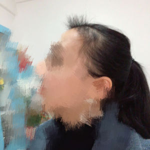 发际线分享社区