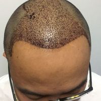 發(fā)際線用戶圖片