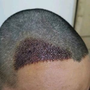 发际线分享社区