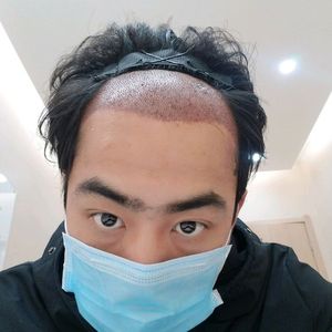 发际线分享社区