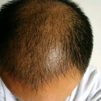 發(fā)際線用戶圖片