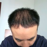 發(fā)際線用戶圖片
