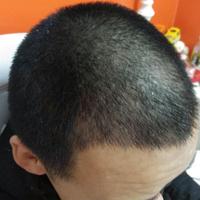 發(fā)際線用戶圖片