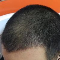 發(fā)際線用戶圖片