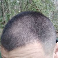 發(fā)際線用戶圖片