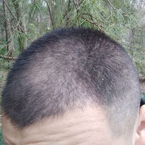 发际线分享社区