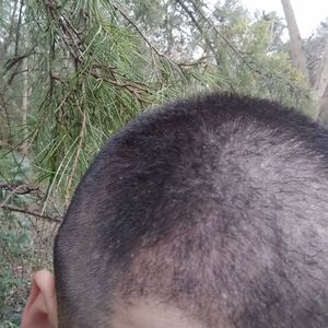 发际线分享社区