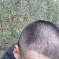 發(fā)際線用戶圖片