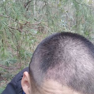 发际线分享社区
